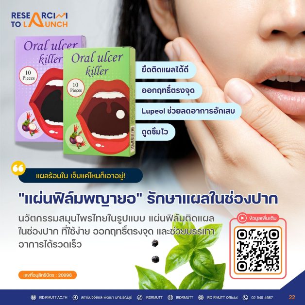 "แผ่นฟิล์มพญายอ" รักษาแผลในช่องปาก